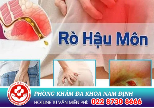 rò hậu môn