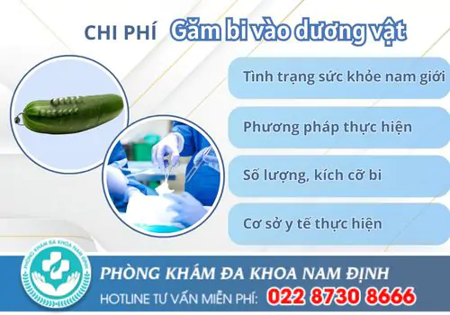 Chi phí găm bi vào dương vật là bao nhiêu?