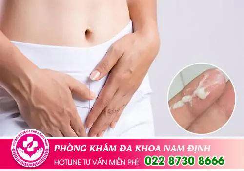 Khí hư có màu trắng sữa có sao không?