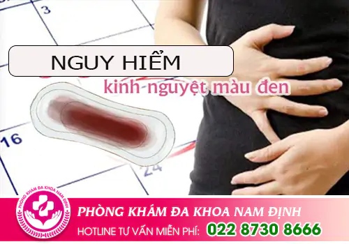 Kinh màu đen bị bệnh gì có nguy hiểm không?