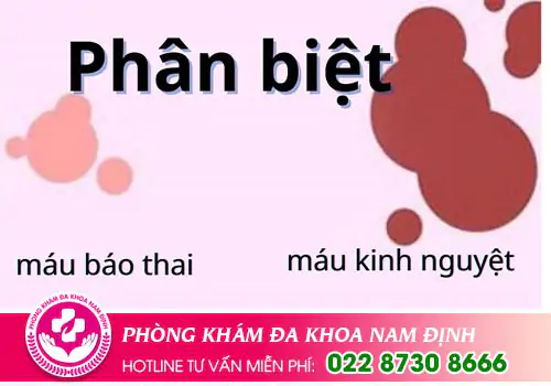 Đặc điểm nhận biết máu báo thai