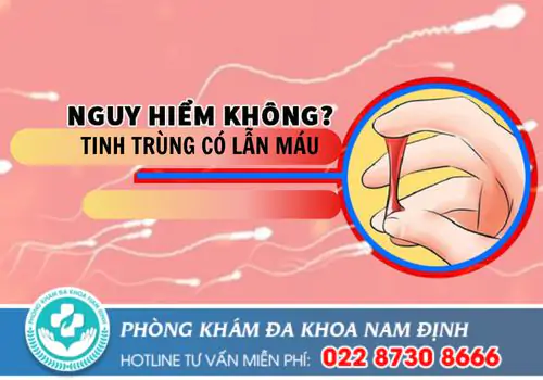 Nguyên nhân tinh trùng lẫn máu và cách chữa hiệu quả
