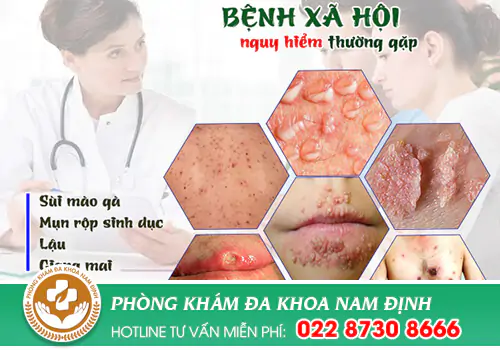 Các triệu chứng bệnh xã hội